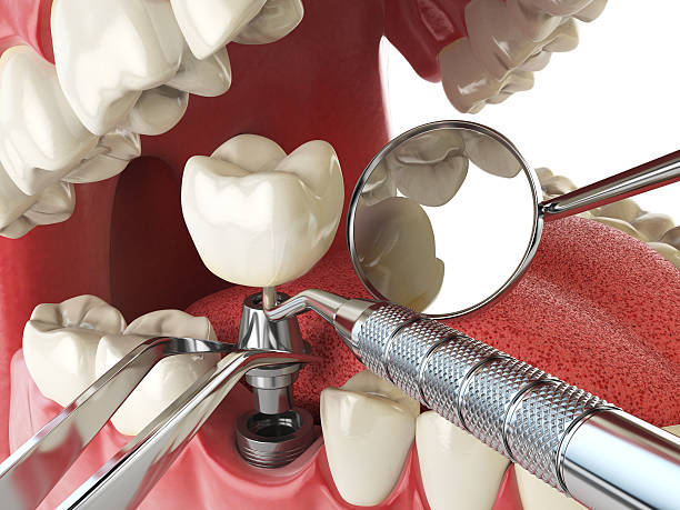 Best Emergency Root Canal Therapy in Wayne, MI
